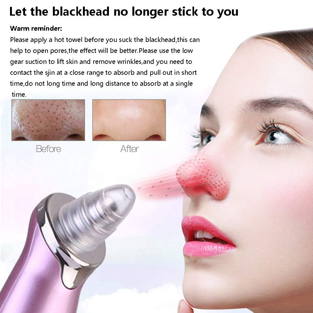 Electric Blackhead Remover, Pore Vacuum Suction, Diamond Dermabrasion Face Cleaner