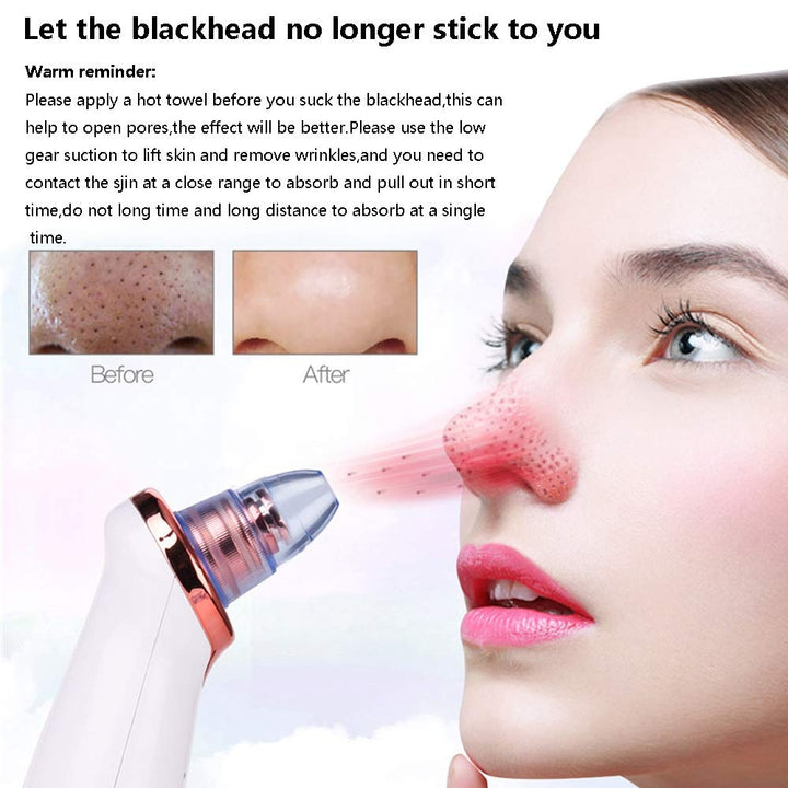 Electric Blackhead Remover, Pore Vacuum Suction, Diamond Dermabrasion Face Cleaner